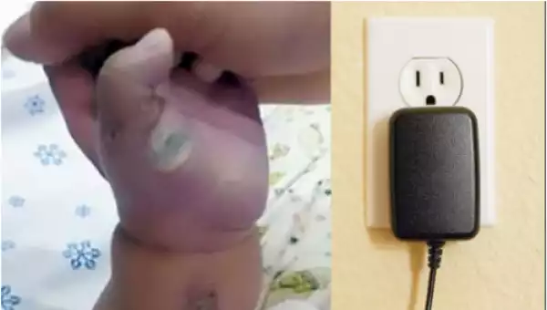 Mothers, Plz Be Careful: This Baby Was Electrocuted While Playing With Smartphone On Charge